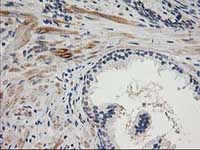 ab124027, at 1/150 dilution, staining TOMM34 in paraffin-embedded Human prostate tissue by Immunohistochemistry.