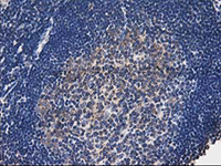 ab124027, at 1/150 dilution, staining TOMM34 in paraffin-embedded Human lymph node tissue by Immunohistochemistry.