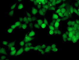 ab124027, at 1/50 dilution, staining TOMM34 in HeLa cells by Immunofluorescence.
