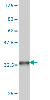 Western blot against tagged recombinant protein immunogen using ab58313 Topoisomerase I antibody at 1ug/ml.
