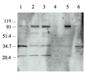 All lanes : Anti-Topoisomerase I antibody - ChIP Grade (ab3825) at 1/5000 dilutionLane 1 : SW210.5 human SCLC cell xenograft lysate. Lane 2 : 5M2 human NSCLC cell lysate (bicarb. buffer).Lane 3 : 5M2 human NSCLC cell lysate (M-Per buffer).Lane 4 : Normal human lung tissue lysate.Lane 5 : A431 cell (human epidermoid carcinoma) lysate .Lane 6 : Rh30 cell (human rhabdomyosarcoma) lysate.Lysates/proteins at 20 µg per lane.SecondaryGoat anti rabbit heavy and light (HRP) at 1/25000 dilutionPerformed under reducing conditions.