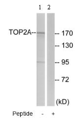 All lanes : Anti-Topoisomerase II alpha antibody (ab74715) at 1/500 dilutionLane 1 : extracts from HT-29 cellsLane 2 : extracts from HT-29 cells with immunizing peptide at 10 µgLysates/proteins at 30 µg per lane.