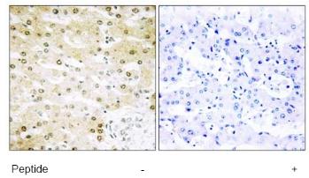 Immunohistochemistry analysis of paraffin-embedded human liver carcinoma tissue using ab74715 at 1/50-1/100 dilution in the presence (+) or absence (-) of immunising peptide. 
