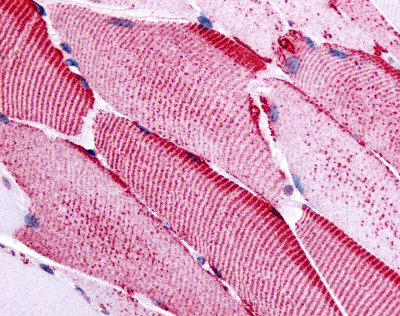 ab61019 at 20µg/ml staining formalin fixed paraffin embedded skeletal muscle tissue