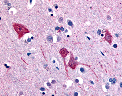 ab61018 at 10µg/ml staining formalin fixed paraffin embedded brain cortex tissue