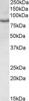 Anti-TORC2 antibody (ab113408) at 0.3 µg/ml + Jurkat cell lysate at 35 µgdeveloped using the ECL technique