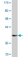 Anti-TORC2 antibody (ab89179) at 5 µg/ml + tagged, recombinant human Torc2 protein fragment (the immunogen) at 0.2 µg/ml