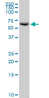 Anti-TORC2 antibody (ab89179) at 5 µg/ml + HeLa cell lysate at 50 µg
