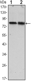 All lanes : Anti-TORC2 antibody [5B10] (ab105932) at 1/500 dilutionLane 1 : Hela cell lysateLane 2 : HEK293 cell lysate