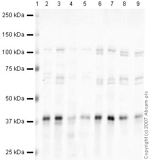 All lanes : Anti-Torsin A antibody (ab34540) at 1 µg/mlLane 1 : MarkerLane 2 : Mouse Brain at 10 µgLane 3 : Testis (Mouse) Whole Cell Lysate - normal tissue at 10 µgLane 4 : Mouse Heart Mouse Tissue Lysate at 10 µgLane 5 : Skeletal Muscle (Mouse) Tissue Lysate (ab29711) at 10 µgLane 6 : Mouse Fetal lysate - 14 Days old Tissue Lysate at 10 µgLane 7 : Brain (Mouse) Tissue Lysate - normal tissue, 0 days old (ab7188) at 10 µgLane 8 : Mouse Embryonic Fibroblast 1 at 10 µgLane 9 : NIH 3T3 (Mouse embryonic fibroblast cell line) Whole Cell Lysate (ab7179) at 10 µgSecondaryIRDye 680 Conjugated Goat Anti-Rabbit IgG (H+L) at 1/15000 dilutionPerformed under reducing conditions.