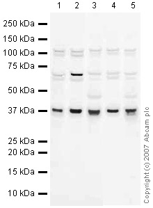 All lanes : Anti-Torsin A antibody (ab34540) at 1 µg/mlLane 1 : NIH 3T3 (Mouse embryonic fibroblast cell line) Whole Cell Lysate (ab7179)Lane 2 : MEF1 (Mouse embryonic fibroblast cell line) Whole Cell LysateLane 3 : Liver (Mouse) Tissue Lysate - normal tissueLane 4 : PC12 (Rat adrenal pheochromocytoma cell line) Whole Cell LysateLane 5 : Liver (Rat) Tissue LysateLysates/proteins at 10 µg per lane.SecondaryIRDye 680 Conjugated Goat Anti-Rabbit IgG at 1/10000 dilutionPerformed under reducing conditions.