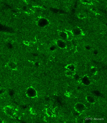 IHC-FoFr image of Torsin A (ab34540) on Rat Cerebral Cortex section. The sections used came from animals perfused fixed with Paraformaldehyde 4%, in phosphate buffer 0.2M. Following postfixation in the same fixative overnight, the brains were cryoprotected in sucrose 30% overnight. Brains were then cut using a cryostat and the immunostainings were performed using the ‘free floating’ technique.See Abreview
