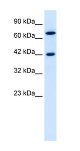 Anti-TOX2 antibody (ab42430) at 0.5 µg/ml + Jurkat cell lysate at 10 µgSecondaryHRP conjugated anti-Rabbit IgG at 1/50000 dilution