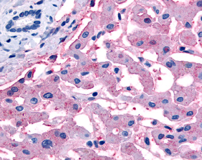 ab61015 at 20µg/ml staining formalin fixed paraffin embedded liver tissue