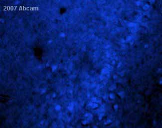 ab14198 at 1/50 staining rat brain hippocampus pyramidal neuron tissue sections by IHC-Fr. The tissue was blocked with horse serum and incubated for 16 hours with the antibody. An AMCA conjugated donkey antibody was used as the secondary.See Abreview