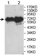 All lanes : Anti-TPA Tissue Plasminogen Activator antibody (ab140088) at 1/1000 dilutionLane 1 : Human fetal brain lysateLane 2 : Human fetal skin lysate