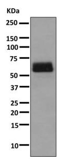 Anti-TPA Tissue Plasminogen Activator antibody [EPR7232(2)] (ab157469) at 1/1000 dilution + Human plasma lysate at 10 µgSecondaryHRP labelled goat anti-rabbit at 1/2000 dilution