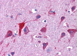ab113952, at 3.75 µg/ml, staining TPD52L2 in Formalin-Fixed, Paraffin-Embedded Human brain cortex tissue by Immunohistochemistry.