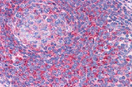 ab113952, at 3.75 µg/ml, staining TPD52L2 in Formalin-Fixed, Paraffin-Embedded Human spleen tissue by Immunohistochemistry.