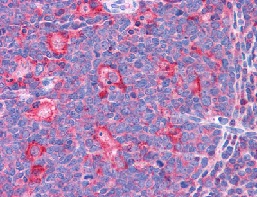 ab113952, at 3.75 µg/ml, staining TPD52L2 in Formalin-Fixed, Paraffin-Embedded Human tonsil tissue by Immunohistochemistry.