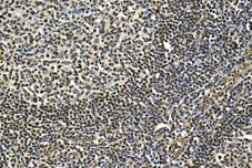 Immunohistochemical analysis of Formalin/PFA-fixed paraffin-embedded Human tonsil tissue labeling TPK1 with ab170863 at a 1/50 dilution.