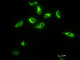 TPMT antibody (ab58340) used in immunofluorescence at 10ug/ml on HeLa cells.