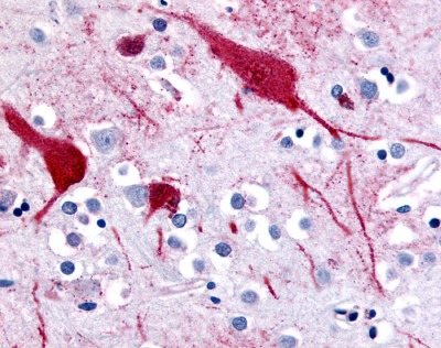 ab61017 at 10µg/ml staining formalin fixed paraffin embedded brain cortex tissue