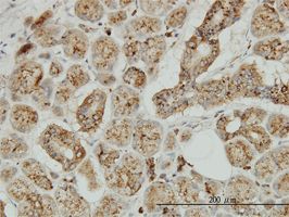TPP1 antibody (ab54685) used in immunohistochemistry at 3ug/ml on formalin fixed and paraffin embedded human salivary gland.