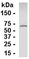Anti-TPTE antibody (ab26195) at 1/2000 dilution + E Coli derived fusion proteinSecondaryGoat anti-IgY HRP