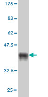 Western blot against tagged recombinant protein immunogen using ab55750 SIM2 antibody at 1ug/ml.