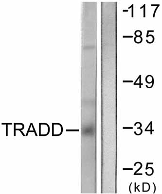 All lanes : Anti-TRADD antibody (ab58443) at 1/500 dilutionLane 1 : COS7 cell extractLane 2 : COS7 cell extract with immunising peptide