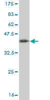 Western blot against tagged recombinant protein immunogen using ab57789 TRADD antibody at 1ug/ml.