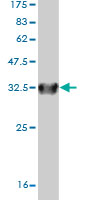 Western blot against tagged recombinant protein immunogen using ab57408 SLC6A20 antibody at 1ug/ml.