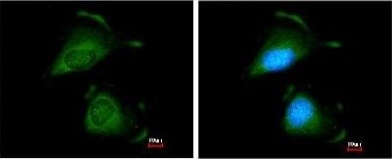 Immunofluorescence analysis of methanol-fixed HeLa cells, labelling TRAF6 using ab137452 at 1/200 dilution. Right panel costained with Hoerchst 33342.