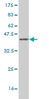 Western blot against tagged recombinant protein immunogen using ab58369 TRAF6 antibody at 1ug/ml.