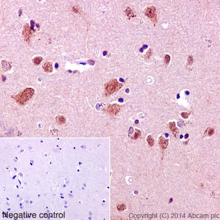 Immunohistochemistry (Formalin/PFA-fixed paraffin-embedded sections) analysis of human cerebral cortex tissue labelling TRAF6 with purified ab40675 at 1/50. Heat mediated antigen retrieval was performed using Tris/EDTA buffer pH 9. ab97051, a HRP-conjugated goat anti-rabbit IgG (H+L) was used as the secondary antibody (1/500). Negative control using PBS instead of primary antibody. Counterstained with hematoxylin.