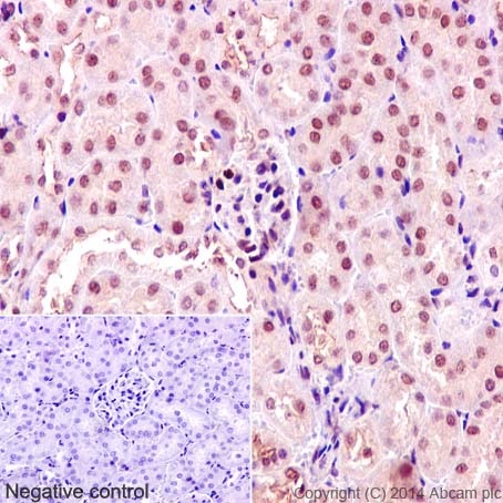 Immunohistochemistry (Formalin/PFA-fixed paraffin-embedded sections) analysis of mouse kidney tissue labelling TRAF6 with purified ab40675 at 1/50. Heat mediated antigen retrieval was performed using Tris/EDTA buffer pH 9. ab97051, a HRP-conjugated goat anti-rabbit IgG (H+L) was used as the secondary antibody (1/500). Negative control using PBS instead of primary antibody. Counterstained with hematoxylin.