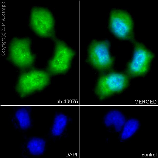 Immunocytochemistry/Immunofluorescence analysis of HeLa cells labelling TRAF6 with purified ab40675 at 1/50. Cells were fixed with 4% paraformaldehyde and permeabilized with 0.1% Triton X-100. ab150077, an Alexa Fluor® 488-conjugated goat anti-rabbit IgG (1/500) was used as the secondary antibody. DAPI (blue) was used as the nuclear counterstain.Control: primary antibody (1/50) and secondary antibody, ab150120, an Alexa Fluor® 594-conjugated goat anti-mouse IgG (1/500).