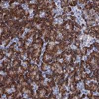 ab122751 at 1/200 dilution, staining SLC7A10 in Paraffin-embedded Human Pancreas tissue by Immunohistochemistry.