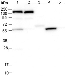 All lanes : Anti-SLC7A10 antibody (ab122751) at 1/250 dilutionLane 1 : RT 4 lysateLane 2 : U 251 MG lysateLane 3 : Human Plasma lysateLane 4 : Human Liver lysateLane 5 : Human Tonsil lysatedeveloped using the ECL techniqueExposure time : 30 seconds