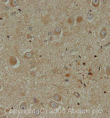 IHC image of TRAIL staining in human hippocampus FFPE section, performed on a BondTM system using the standard protocol F. The section was pre-treated using heat mediated antigen retrieval with sodium citrate buffer (pH6, epitope retrieval solution 1) for 20 mins. The section was then incubated with ab42121, 1ug/ml, for 15 mins at room temperature and detected using an HRP conjugated compact polymer system. DAB was used as the chromogen. The section was then counterstained with haematoxylin and mounted with DPX.