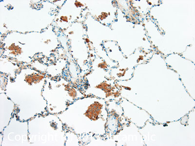 IHC image of TRAIL staining in Human normal lung formalin fixed paraffin embedded tissue section, performed on a Leica BondTM system using the standard protocol F. The section was pre-treated using heat mediated antigen retrieval with sodium citrate buffer (pH6, epitope retrieval solution 1) for 20 mins. The section was then incubated with ab42121, 1µg/ml, for 15 mins at room temperature and detected using an HRP conjugated compact polymer system. DAB was used as the chromogen. The section was then counterstained with haematoxylin and mounted with DPX. For other IHC staining systems (automated and non-automated) customers should optimize variable parameters such as antigen retrieval conditions, primary antibody concentration and antibody incubation times.