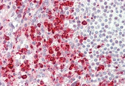 Immunohistochemical analysis of formalin-fixed, paraffin-embedded Human spleen tissue labeling TRAM1 with ab192671 at 1/100 dilution.