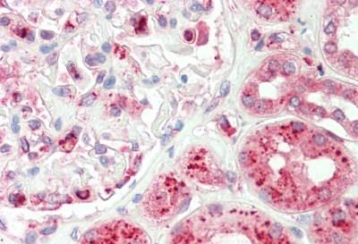 Immunohistochemical analysis of formalin-fixed, paraffin-embedded Human kidney tissue labeling TRAM1 with ab192671 at 1/100 dilution.