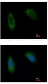 Immunofluorescent analysis of methanol-fixed HeLa cells labeling TRAM1 with ab192671 at 1/500 dilution.The lower image was costained with Hoechst 33342.