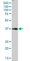 Anti-Transaldolase 1 antibody (ab67467) at 1/500 dilution + human kidney tissue lysate at 25 µg/mlSecondaryGoat Anti-Mouse IgG (H&L)-HRP Conjugate at 1/2500 dilution