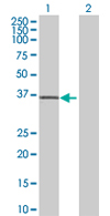 All lanes : Anti-Transaldolase 1 antibody (ab67467) at 1/500 dilutionLane 1 : Transaldolase 1 transfected 293T cell lysateLane 2 : Non-transfected 293T cell lysateLysates/proteins at 25 µg/ml per lane.SecondaryGoat Anti-Mouse IgG (H&L)-HRP Conjugate at 1/2500 dilution