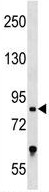 Anti-Transcription factor 25 antibody (ab130620) at 1/100 dilution + CEM cell line lysates at 35 µg