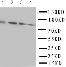 All lanes : Anti-Transcription factor Sp4 antibody (ab151777) at 0.5 µg/mlLane 1 : Rat spleen tissue lysateLane 2 : HeLa cell lysateLane 3 : Jurkat cell lysateLane 4 : A549 Cell Lysate
