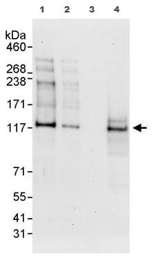 All lanes : Anti-Transcription termination factor 1 antibody (ab87726) at 0.04 µg/mlLane 1 : Whole cell lysate from HeLa cells at 50 µgLane 2 : Whole cell lysate from HeLa cells at 15 µgLane 3 : Whole cell lysate from HeLa cells at 5 µgLane 4 : Whole cell lysate from 293T cells at 50 µgdeveloped using the ECL technique